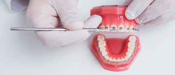 Does Medical Aid Cover Braces?